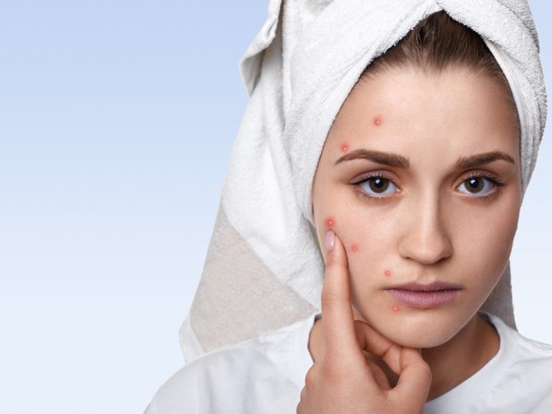 The Benefits of Using Tretinoin for Acne and Wrinkles