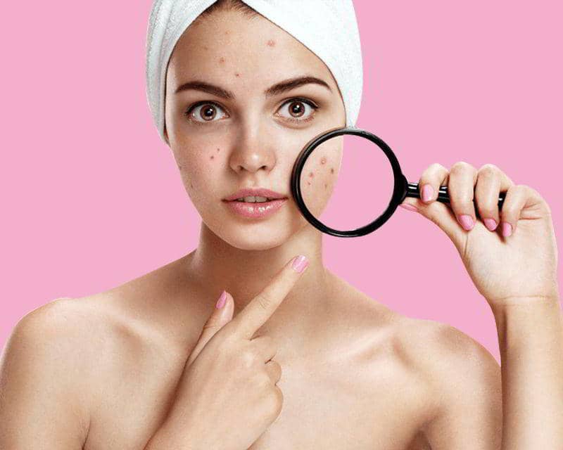 Unlocking Clear Skin: The Power of Tretinoin